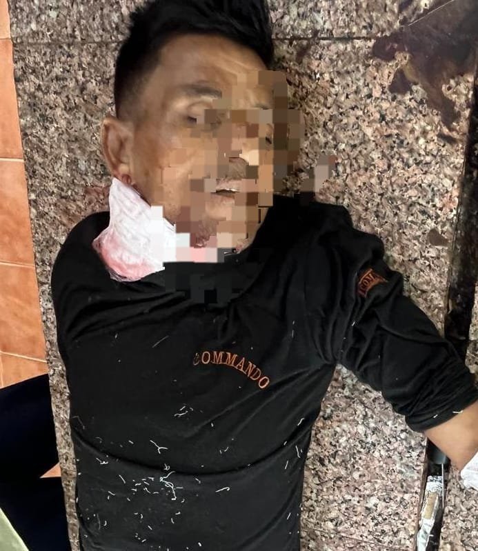 खूनी अंजाम: एक ही कमरे में सो रहा था पत्नी का प्रेमी, पति ने कुल्हाड़ी मारकर कर दी हत्या; एसपी धमतरी के निर्देशन में आरोपी जेल रवाना WhatsApp Image 2026 07 09 at 15.47.32