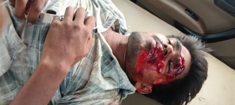 अज्ञात वाहन की टक्कर से बाइक सवार युवक घायल WhatsApp Image 2026 09 22 at 09.12.50
